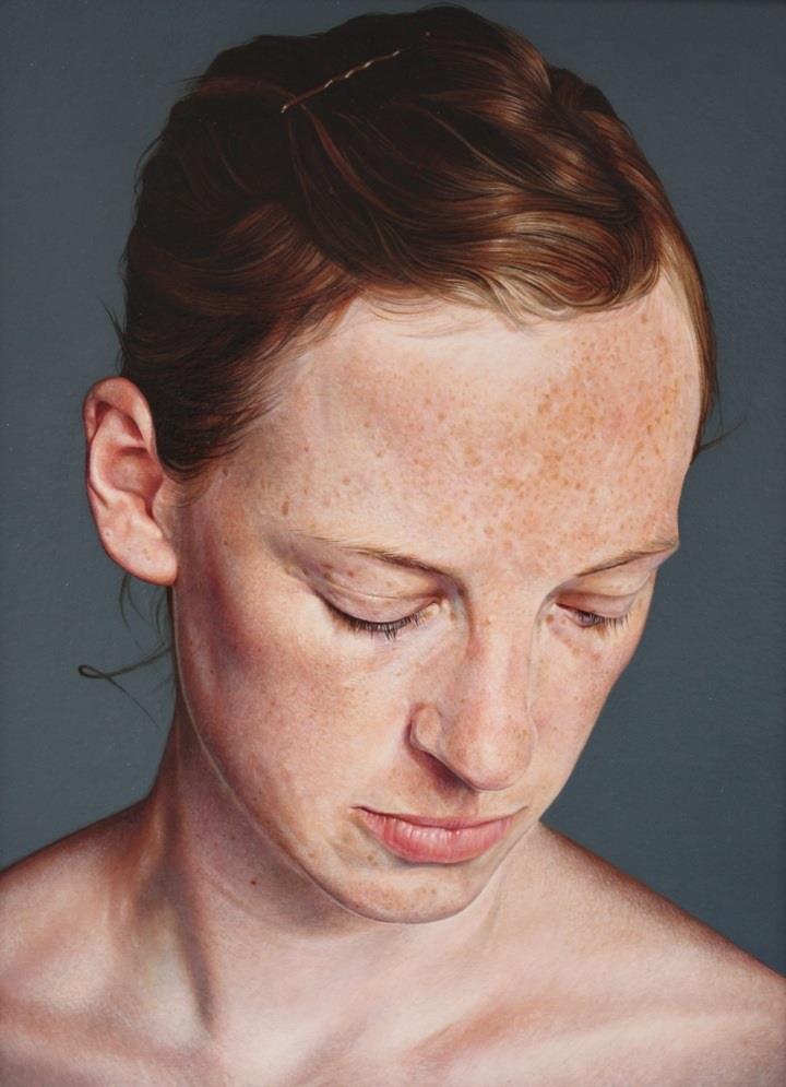 Alan Coulson - freckles