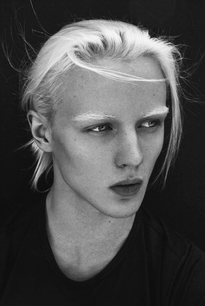 Kait Robinson - portrait albino